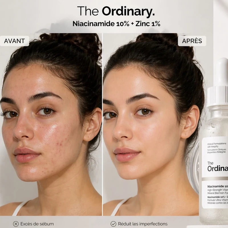 Serum Ordinary