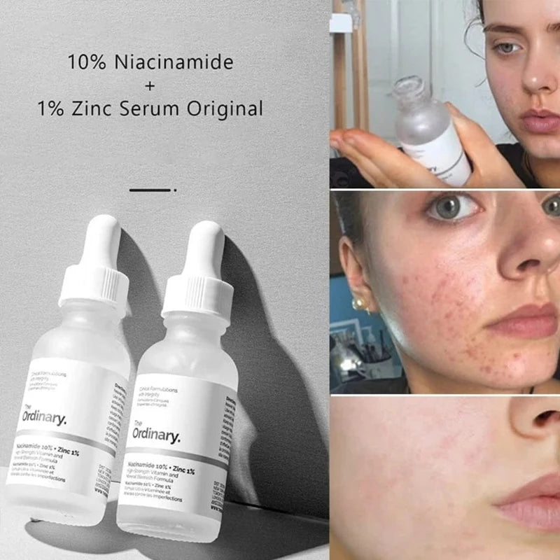 Serum Ordinary